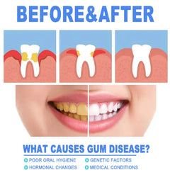 Teeth Repair Gel